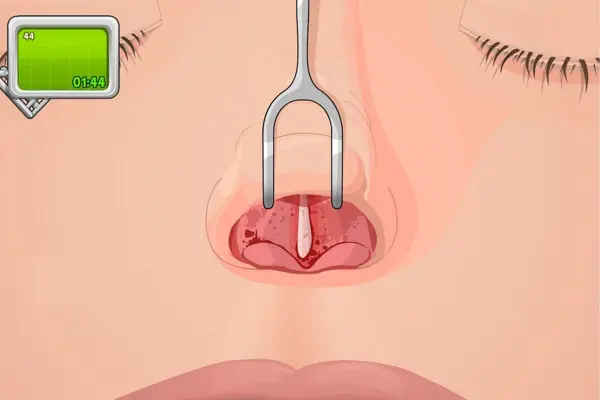 Operate Now Nose Surgery android App screenshot 0