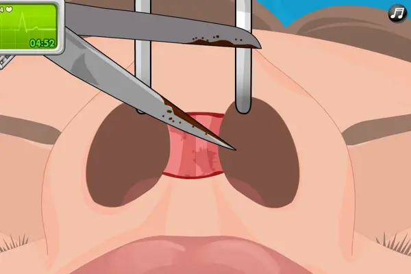 Operate Now Nose Surgery android App screenshot 1